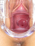 #759 Miela 40nmnhbg0p